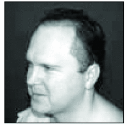Figure 14B.