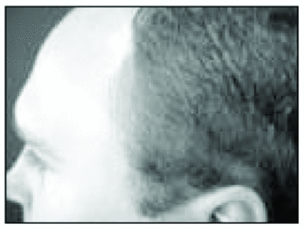 Figure 14D.
