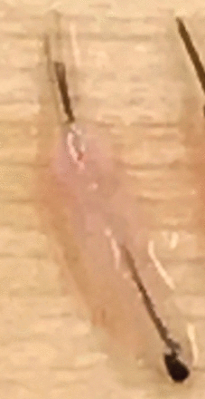 FIGURE 10.