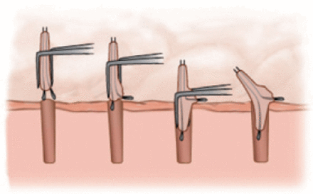 FIGURE 11.