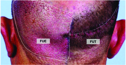 FIGURE 3.