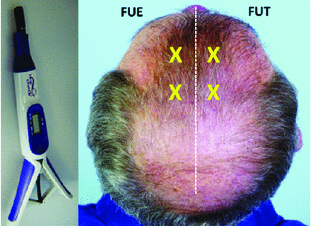 FIGURE 4.