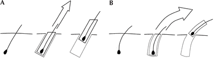 FIGURE 12.