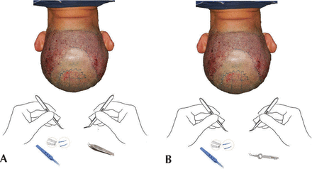 FIGURE 7.