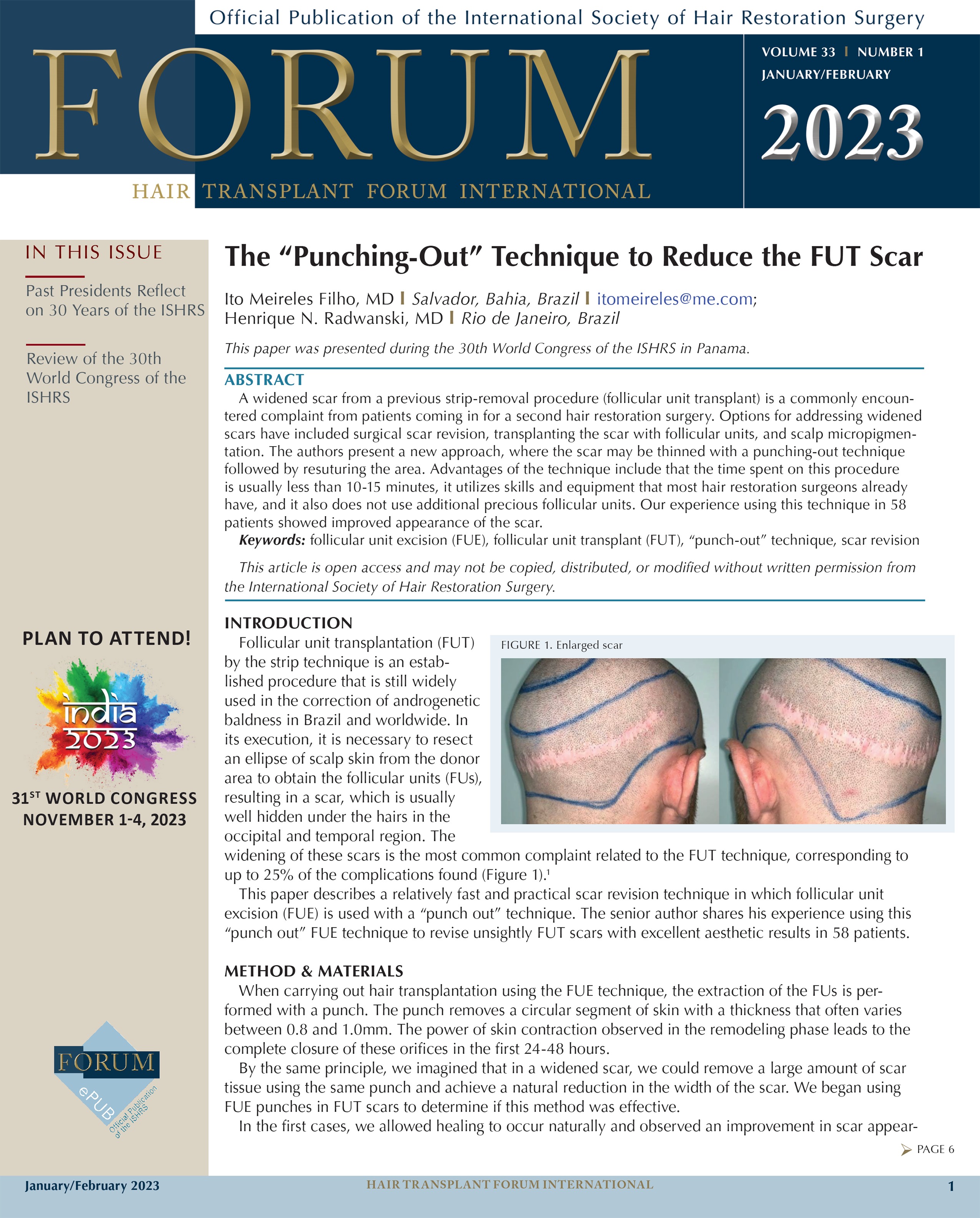 Table of Contents — January 01, 2023, 33 (1) Hair Transplant Forum