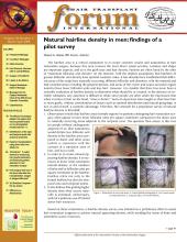 International Society of Hair Restoration Surgery: 19 (2)