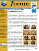 International Society of Hair Restoration Surgery: 21 (6)