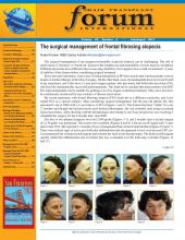 International Society of Hair Restoration Surgery: 23 (4)