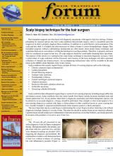 International Society of Hair Restoration Surgery: 23 (5)