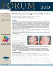 International Society of Hair Restoration Surgery: 33 (1)